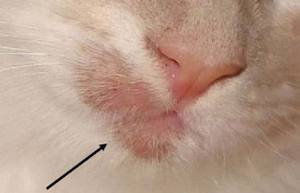 איך להתגבר על גזזת