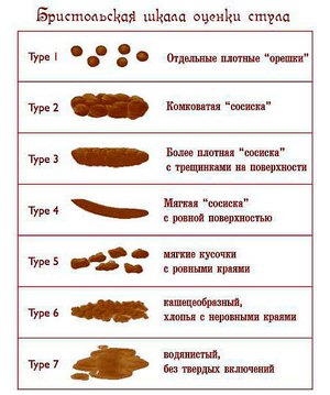 איך להאכיל חתול בצורה נכונה כדי שלא יסבול מעצירות.