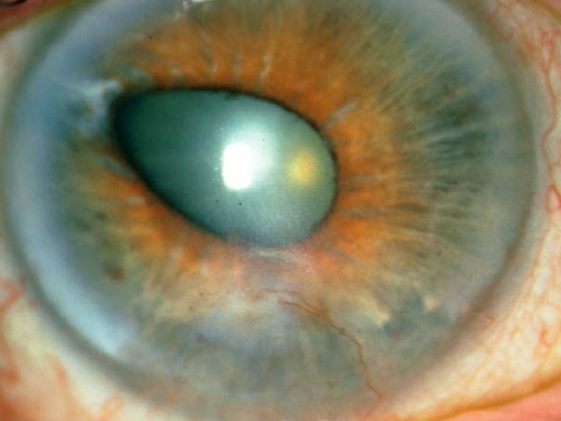 לחתול יש עיניים כואבות