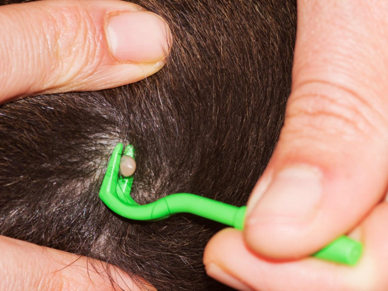 שיטות ויזואליות של הדברת קרציות שיטות למאבק בקרציות