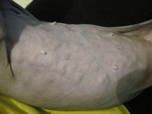 גושים תת-עוריים בחתול מעוקר גושים מתחת לעור של חתול לאחר עיקור - מאיפה הם מגיעים?