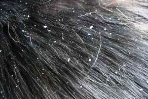 קשקשים וגירוד אצל כלבים: גורמים וטיפול קשקשים וגירוד אצל כלבים יכולים להיות סימנים למחלה.