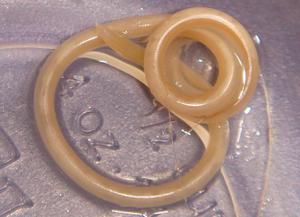 טיפול בהלמינתים יכול להיות מהיר בעזרת תרופות.