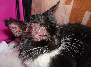 אילו תרופות משמשות לטיפול בליזן?