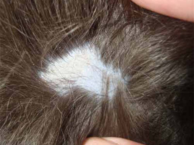 תסמינים של חזזית תסמינים של גזזת