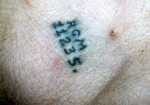 סמל של כלב ממוקם לעתים קרובות במפשעה - זהו מיקום נוח שאינו פוגע במראה הכלב.