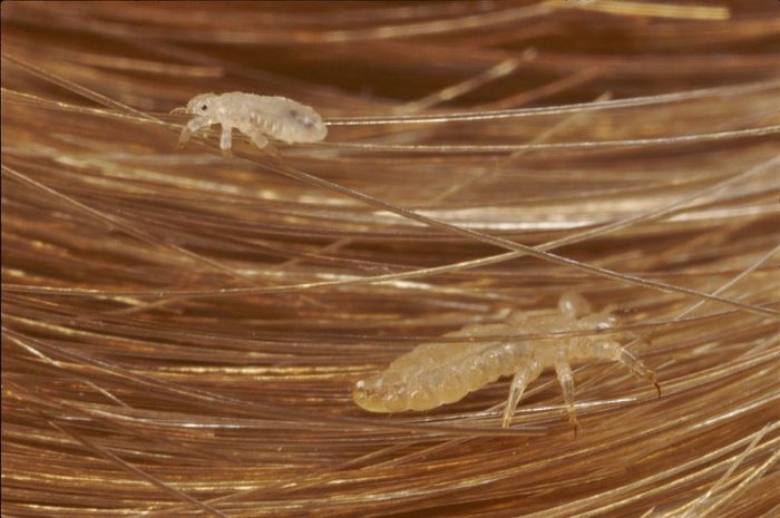 כינים על השיער