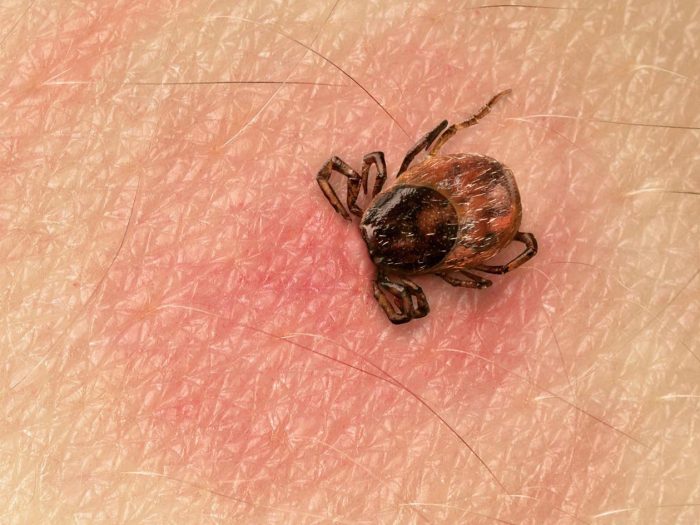 קרצית ומקום הנשיכה שלה