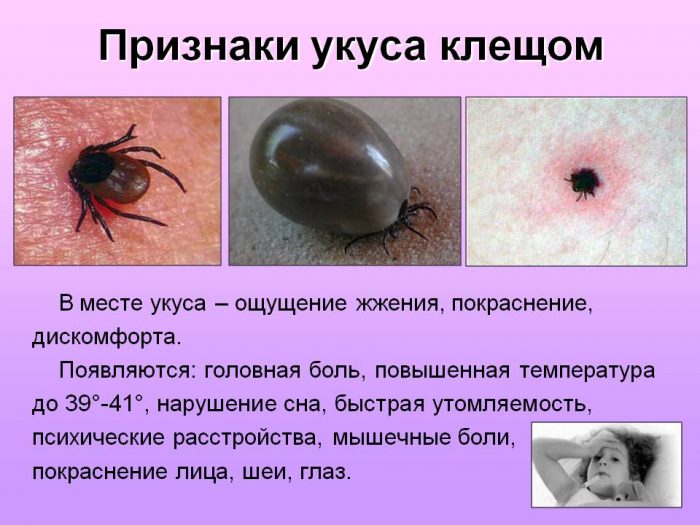 סימנים של עקיצת קרציה