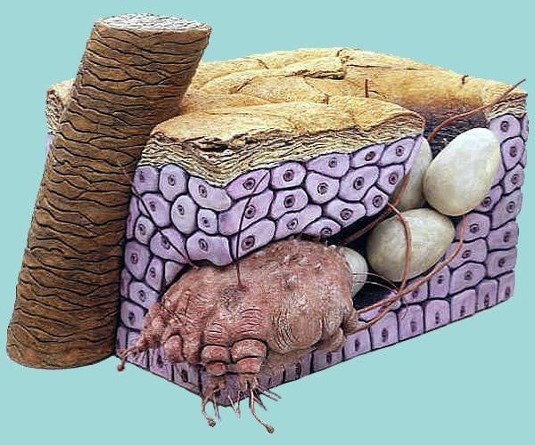 תקריב של קרדית גרדת