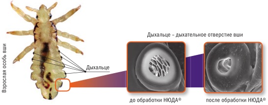השפעת דימתיקון על כינים