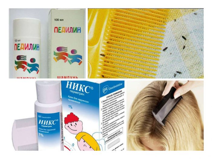 תרופות נגד כינים מסוג פדילין וניקס ותהליך הסירוק