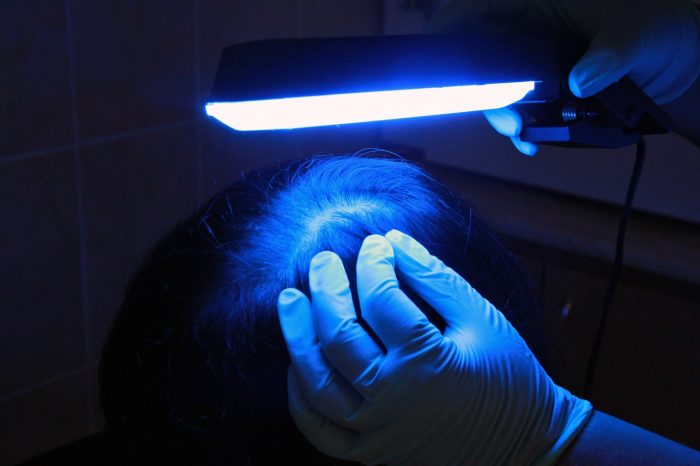 גילוי ביצים באמצעות מנורת ווד