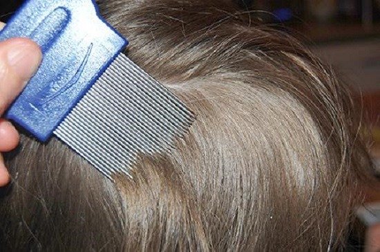 תהליך סירוק כינים וביצים בעזרת מסרק מיוחד