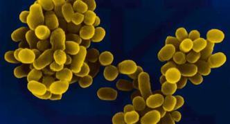 הגורם הסיבתי של ברוצלוזיס