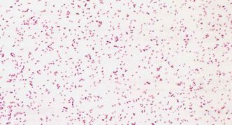 הגורם הסיבתי של פסטרלוזיס