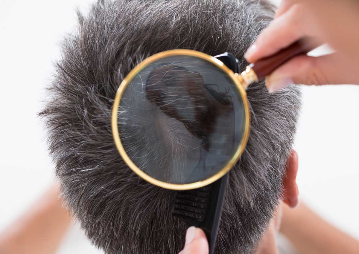 כינים: מאיפה הן מגיעות וכיצד להימנע מהדבקה