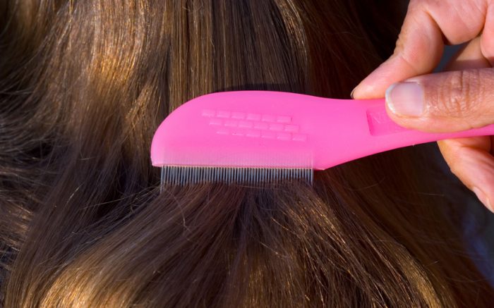 סירוק כינים בעזרת מסרק מיוחד