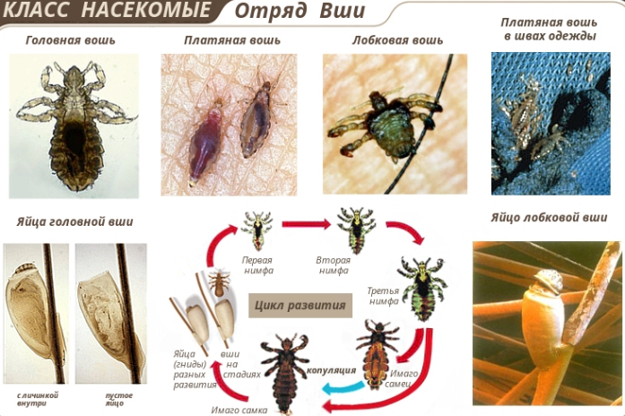 סוגי כינים ומחזור ההתפתחות שלהם
