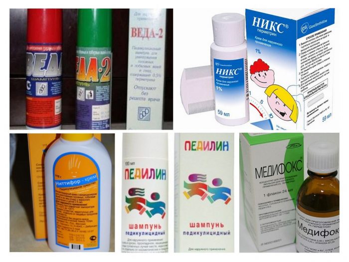 חמש תרופות לטיפול בכיני ראש