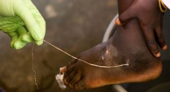 חילוץ חוטים