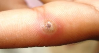 מיקום האצבע