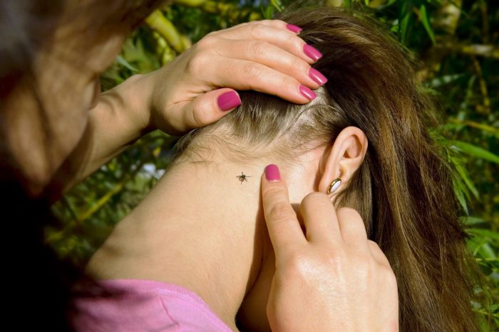 עקיצת קרציה