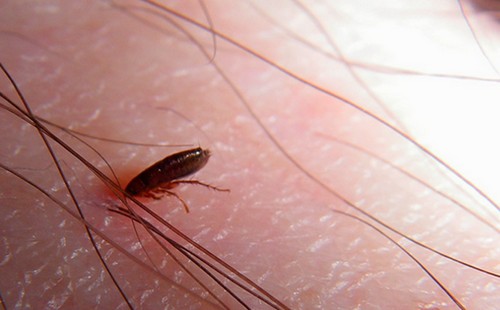 פרעוש על העור עם שיער