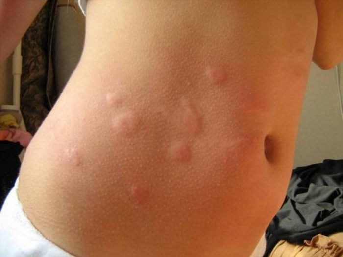 פריחות על תא המטען