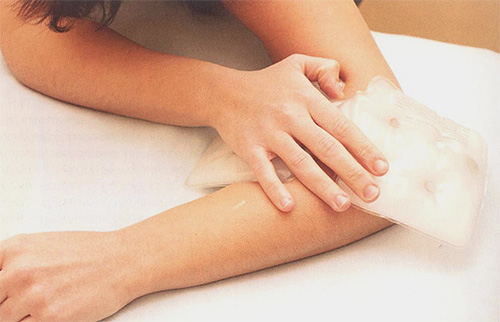 ילדה מניחה קומפרס קר על כיפוף מרפקה.