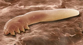 קרדית תת עורית, ארוכה כמו תולעת