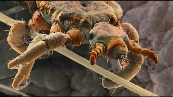 כינה תחת מיקרוסקופ