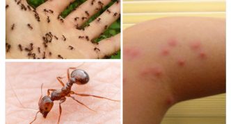 עקיצות נמלים