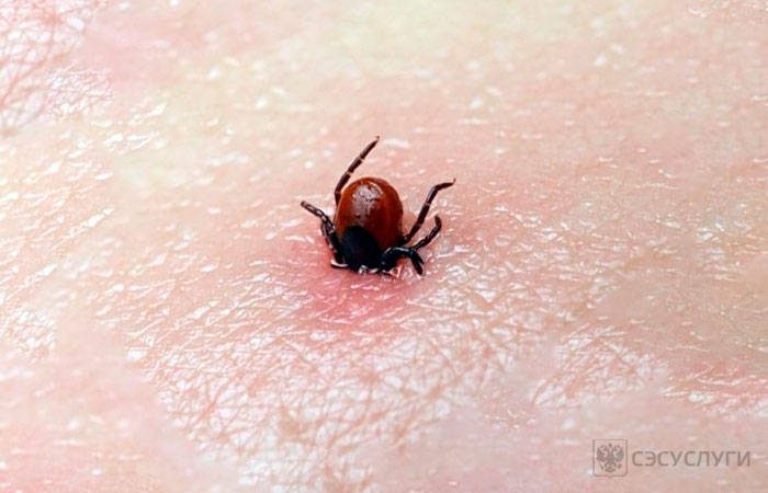 עקיצת קרציה