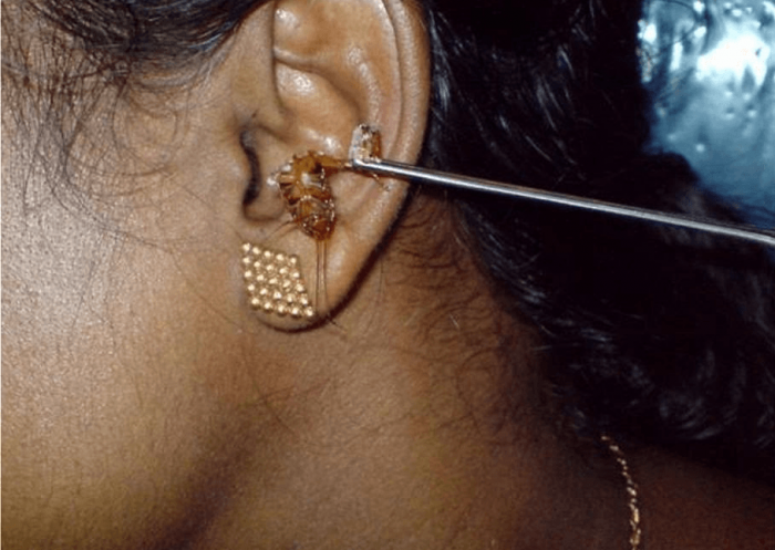 ג'וק נשלף מאוזן